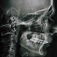 Profile xray of man jaw for dentist